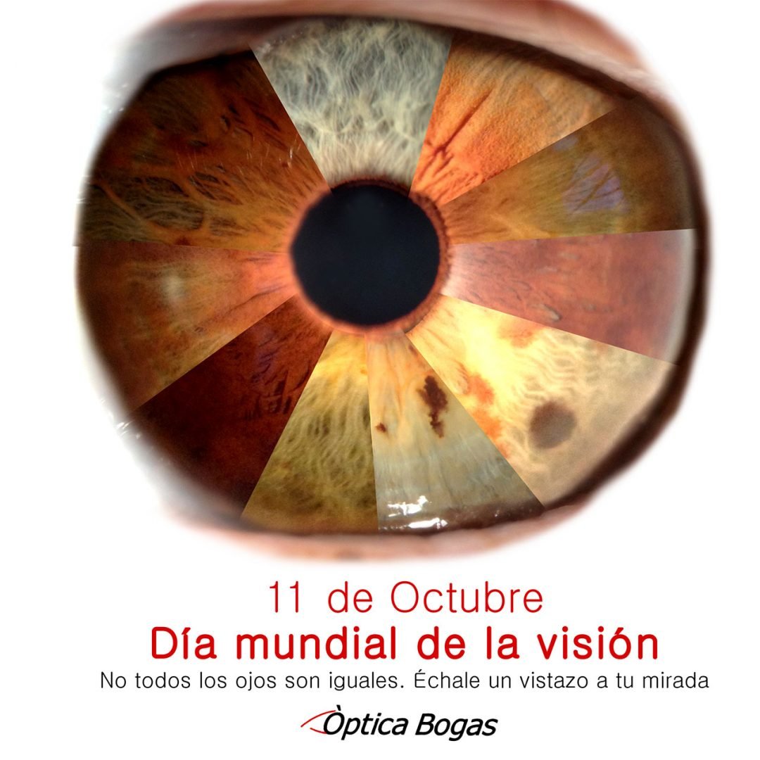 diavision2 Òptica Bogas